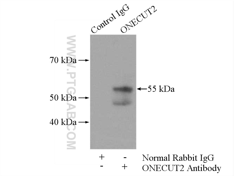 IP experiment of HEK-293 using 21916-1-AP