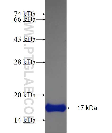 ONECUT2 fusion protein Ag17018 SDS-PAGE ONECUT2 fusion protein Ag17018 SDS-PAGE