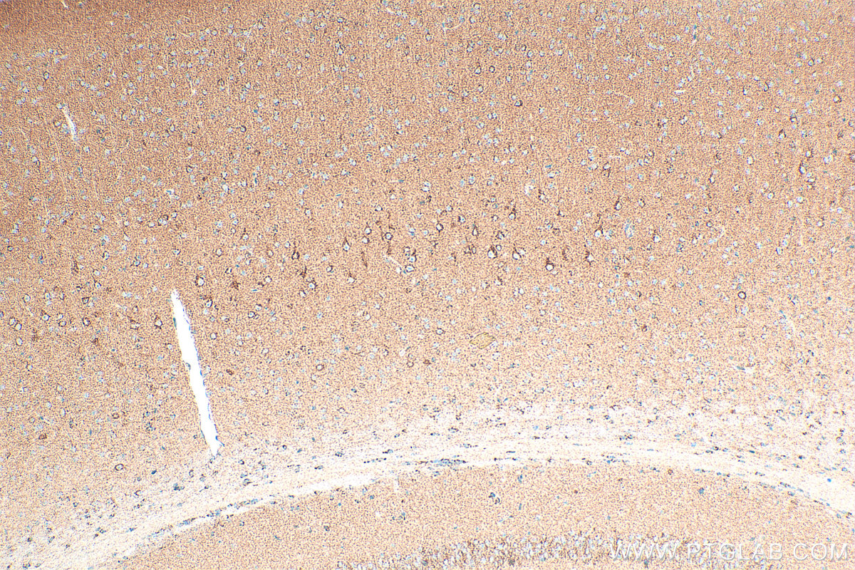 IHC staining of mouse brain using 32465-1-AP IHC staining of mouse brain using 32465-1-AP