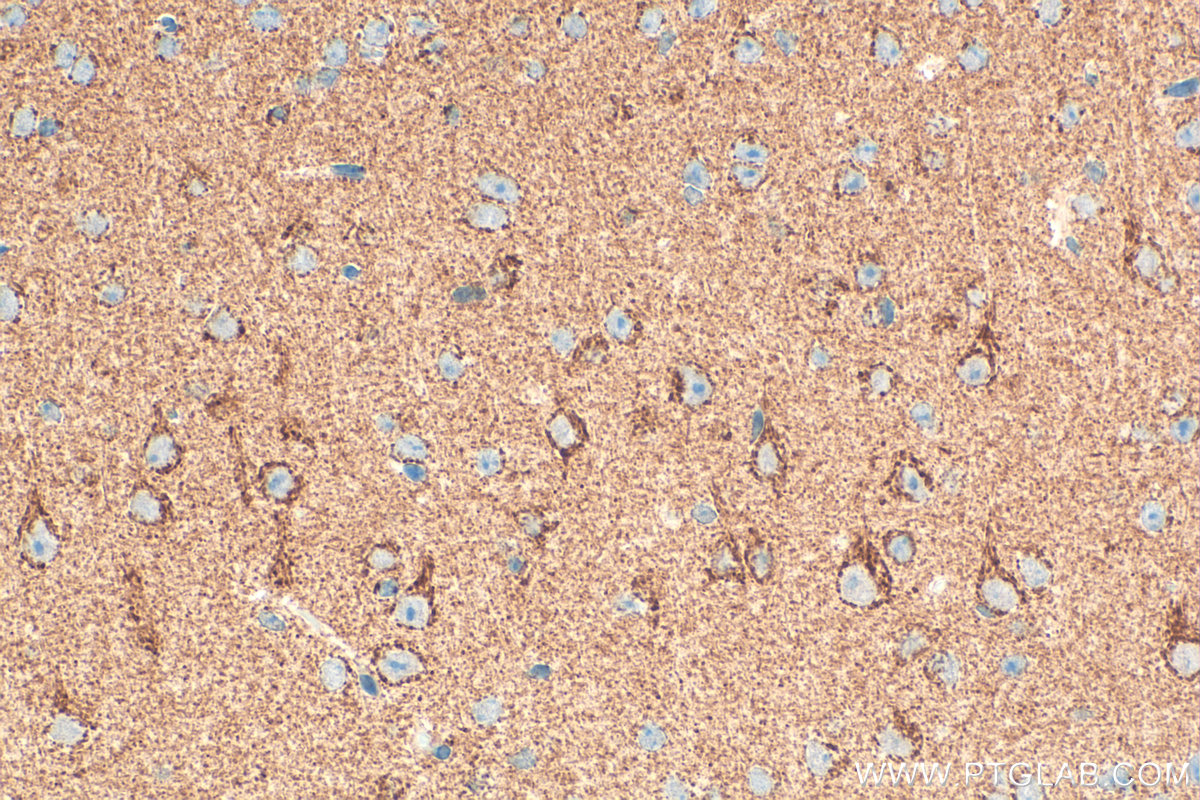 IHC staining of mouse brain using 32465-1-AP IHC staining of mouse brain using 32465-1-AP