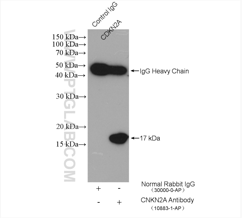 IP experiment of HeLa using 15638-1-AP