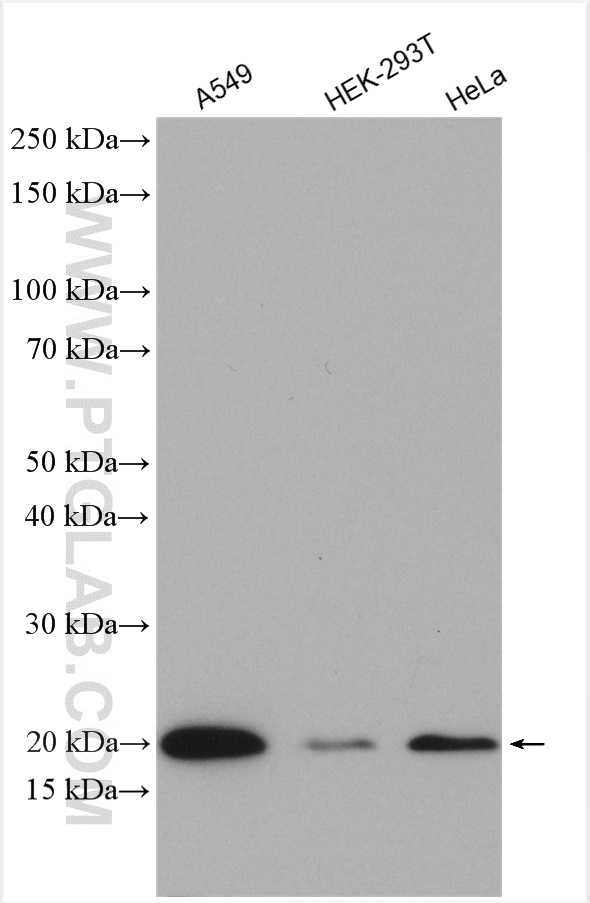 WB analysis using 15638-1-AP