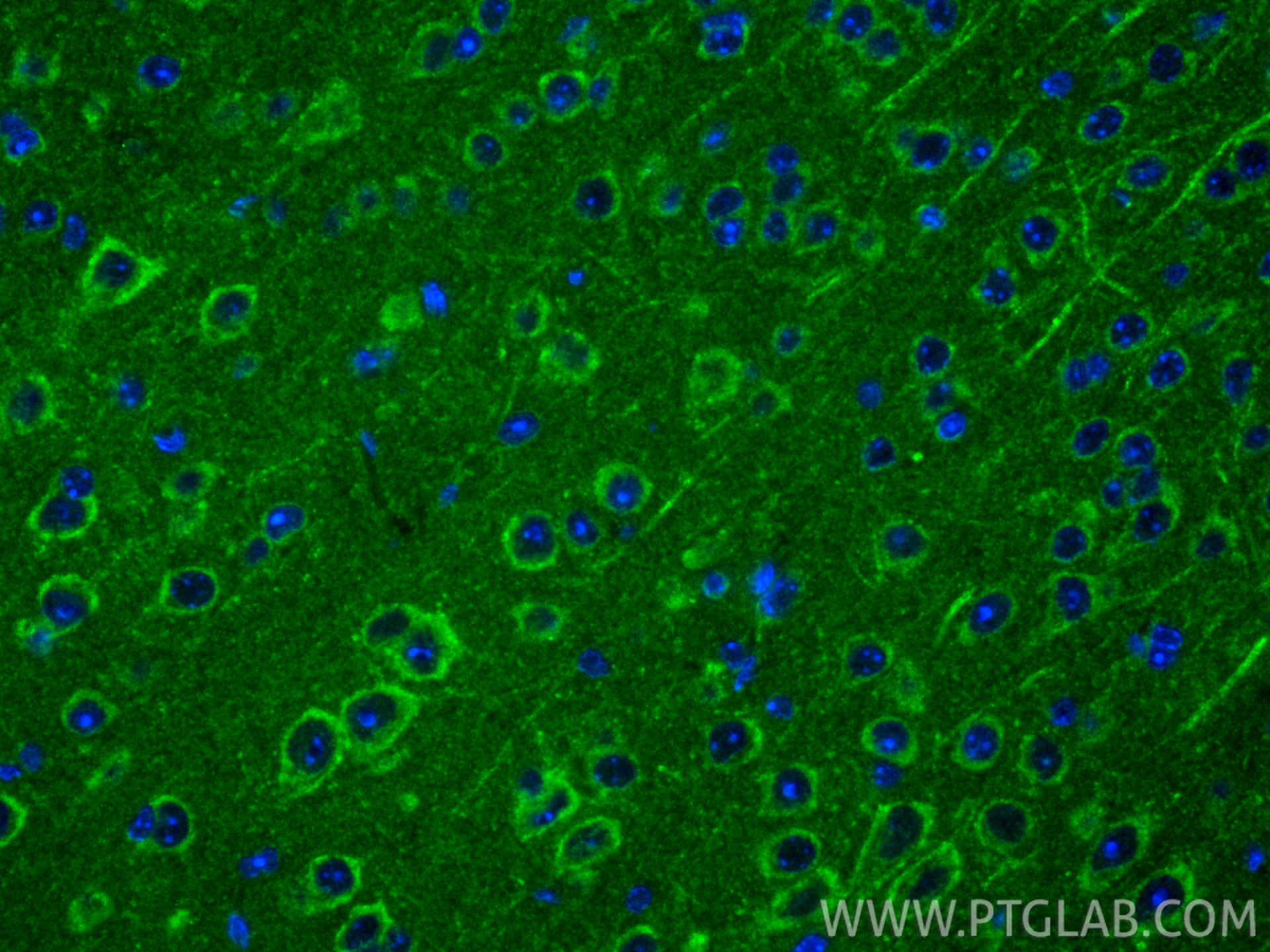IF Staining of mouse brain using 17962-1-AP