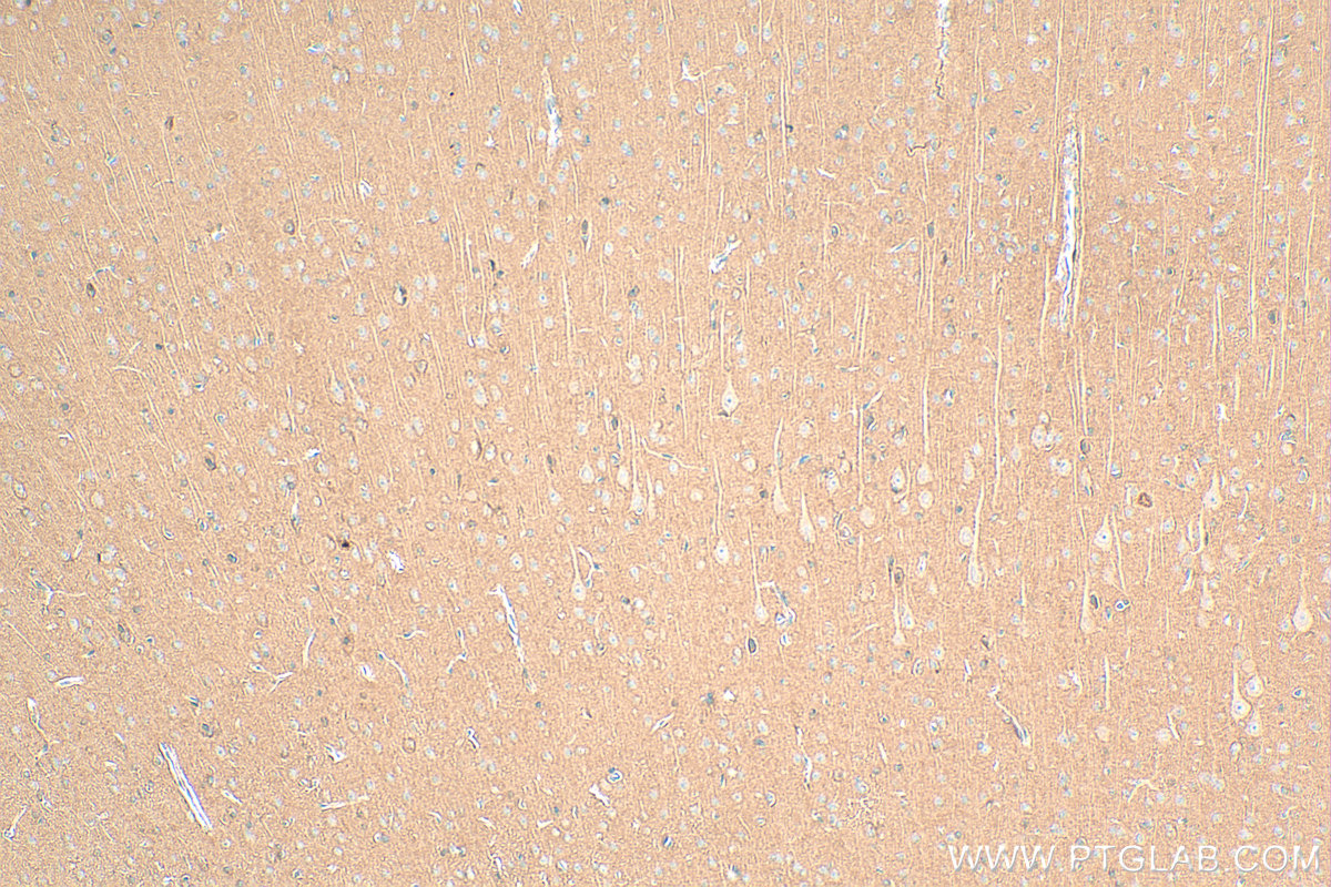 IHC staining of rat brain using 17962-1-AP