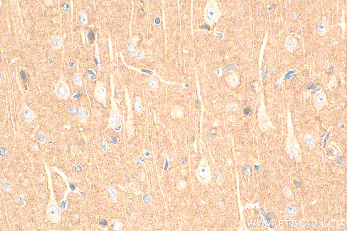 IHC staining of rat brain using 17962-1-AP
