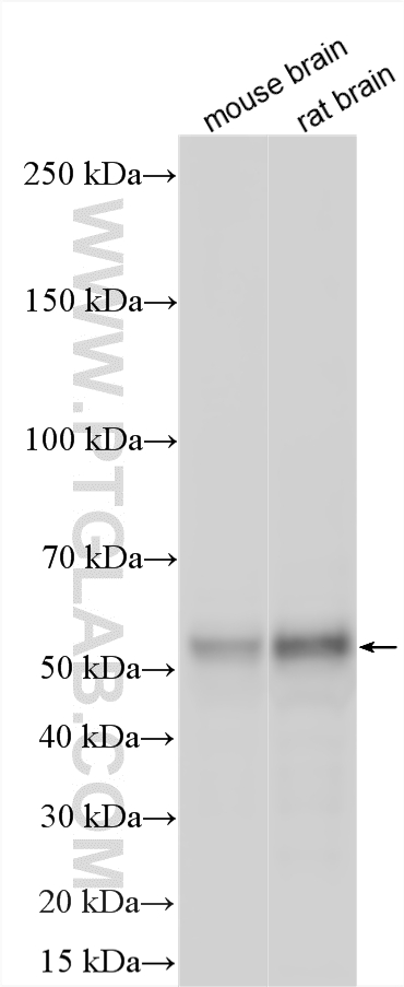 WB analysis using 17962-1-AP WB analysis using 17962-1-AP