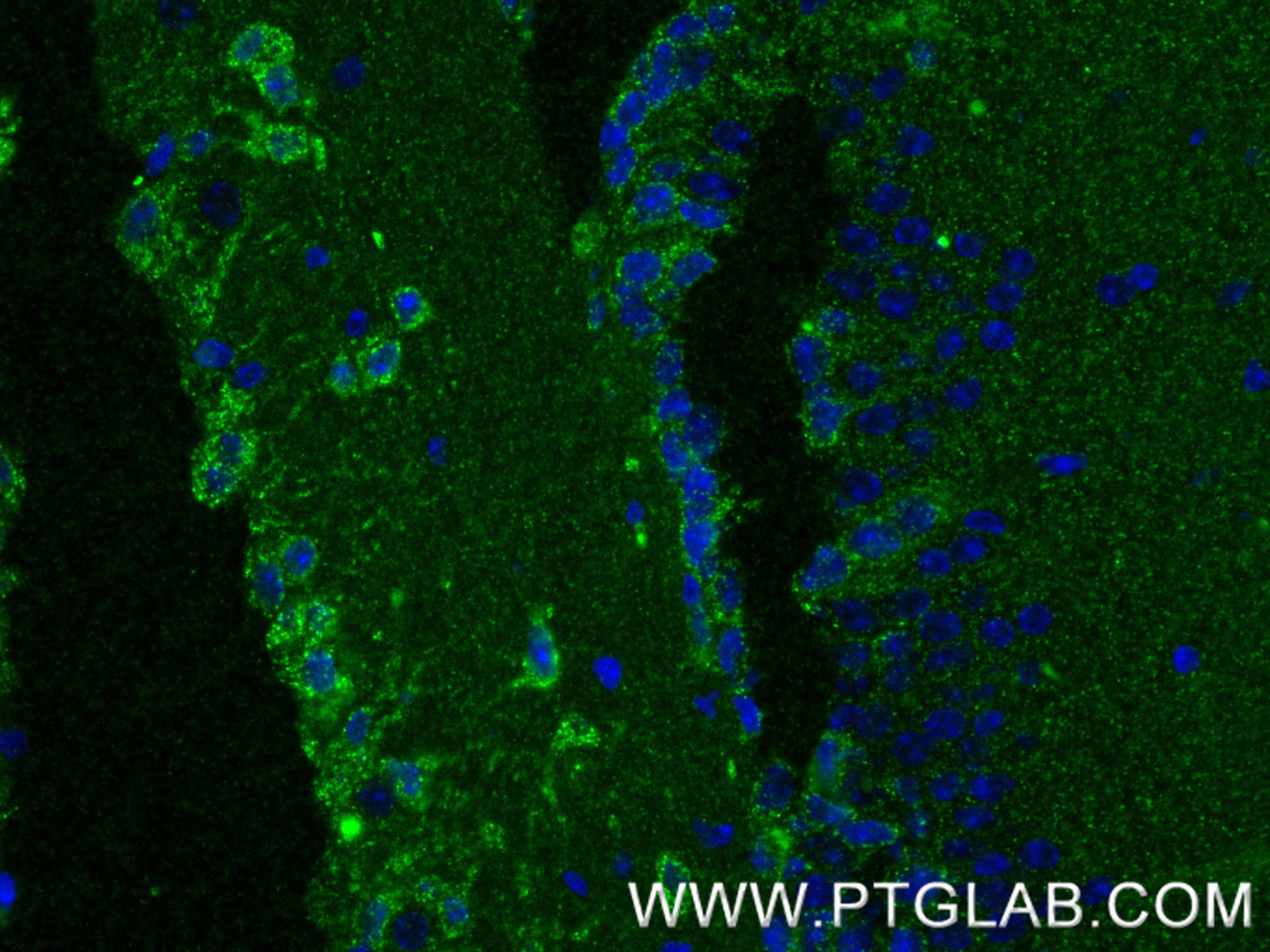 IF Staining of mouse brain using 87815-1-RR IF Staining of mouse brain using 87815-1-RR