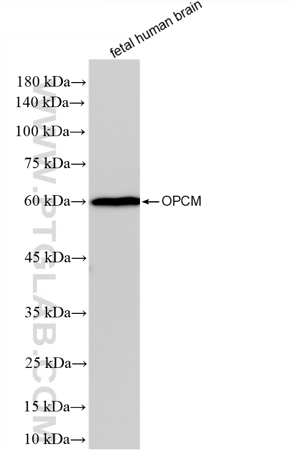 WB analysis of fetal human brain using 87815-1-RR WB analysis of fetal human brain using 87815-1-RR