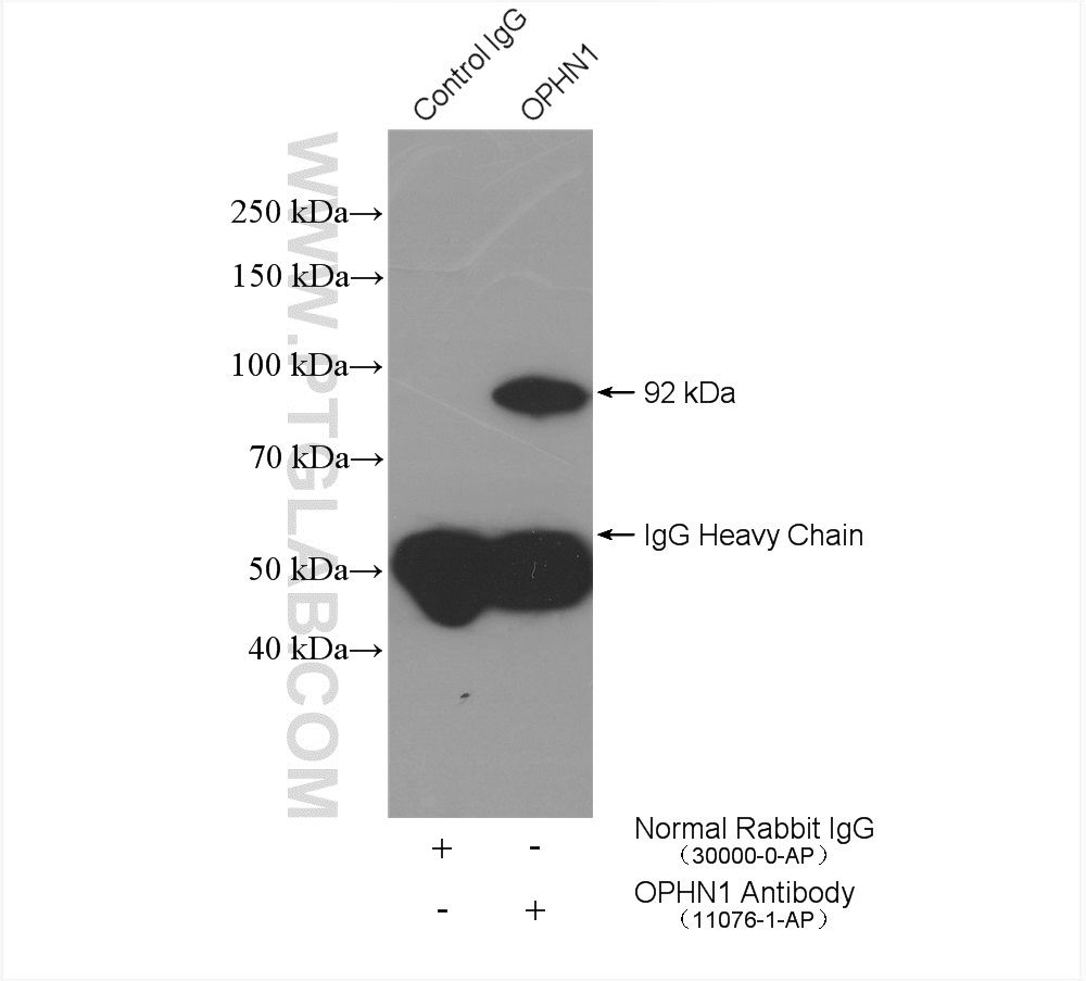 IP experiment of mouse brain using 11076-1-AP