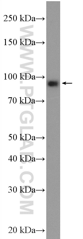 WB analysis of HeLa using 11076-1-AP