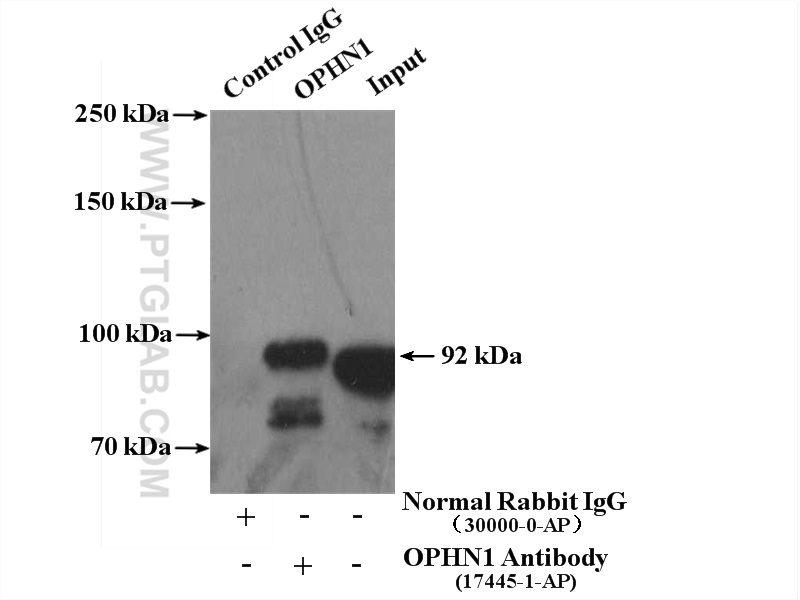 IP experiment of mouse brain using 17445-1-AP