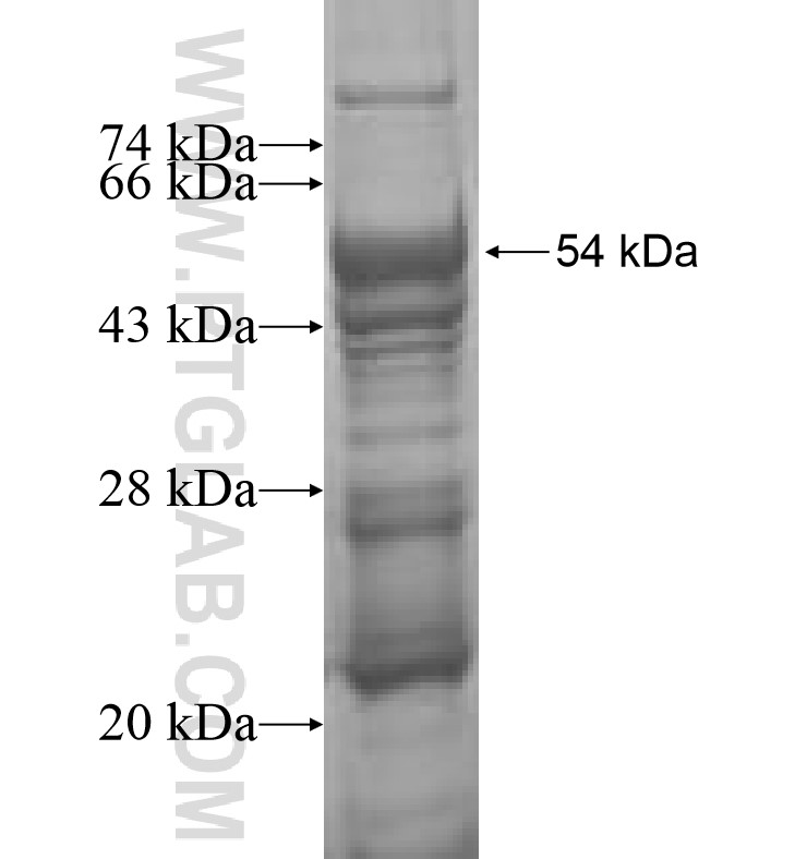 OPHN1 fusion protein Ag1224 SDS-PAGE OPHN1 fusion protein Ag1224 SDS-PAGE