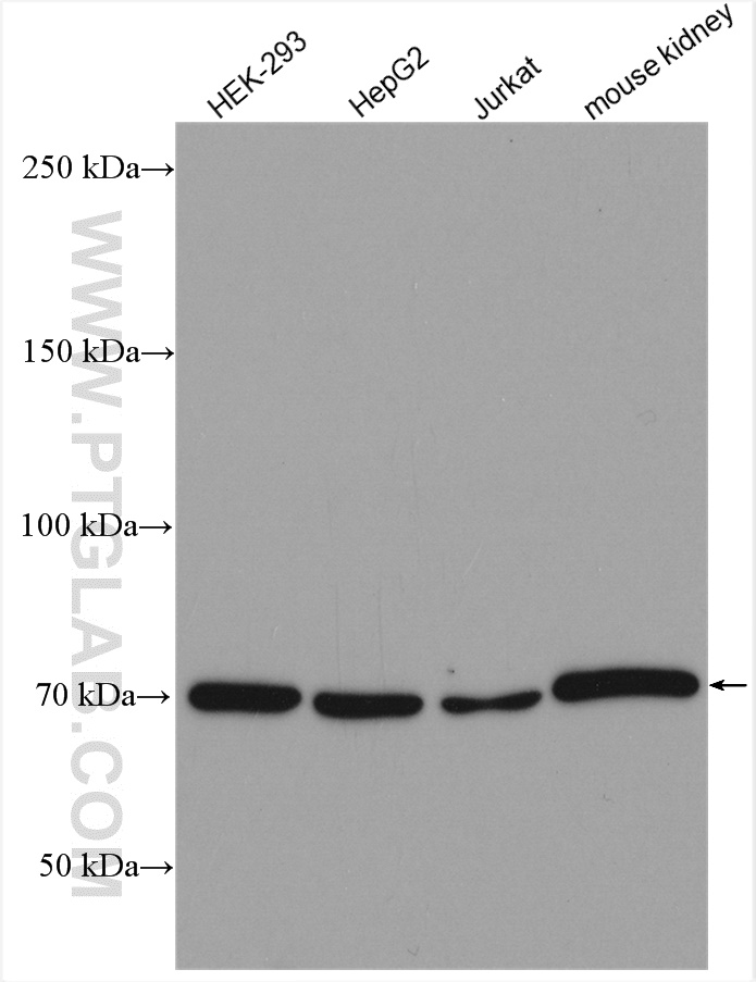 WB analysis using 22952-1-AP