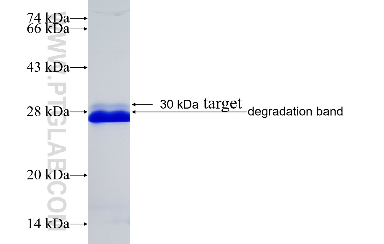OPN, SPP1 fusion protein Ag34190 SDS-PAGE OPN, SPP1 fusion protein Ag34190 SDS-PAGE
