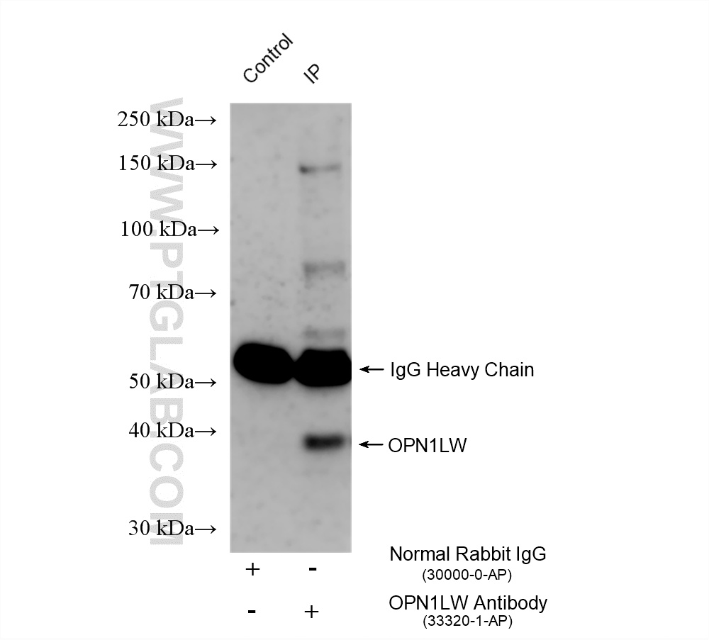 IP experiment of mouse retina using 33320-1-AP