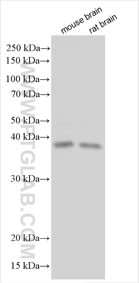 WB analysis of mouse brain using 30975-1-AP