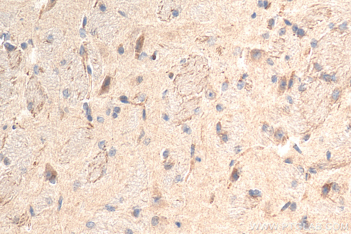 IHC staining of mouse brain using 12970-1-AP