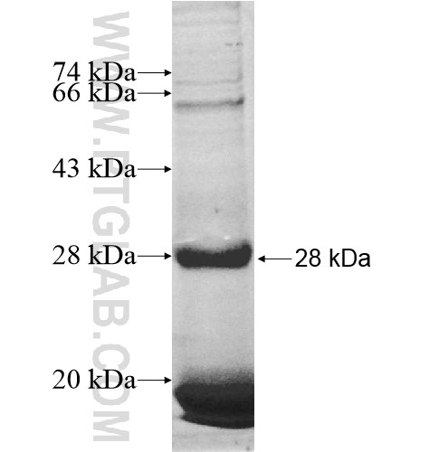 OPRM1 fusion protein Ag13047 SDS-PAGE OPRM1 fusion protein Ag13047 SDS-PAGE