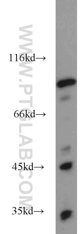 WB analysis of mouse brain using 17897-1-AP