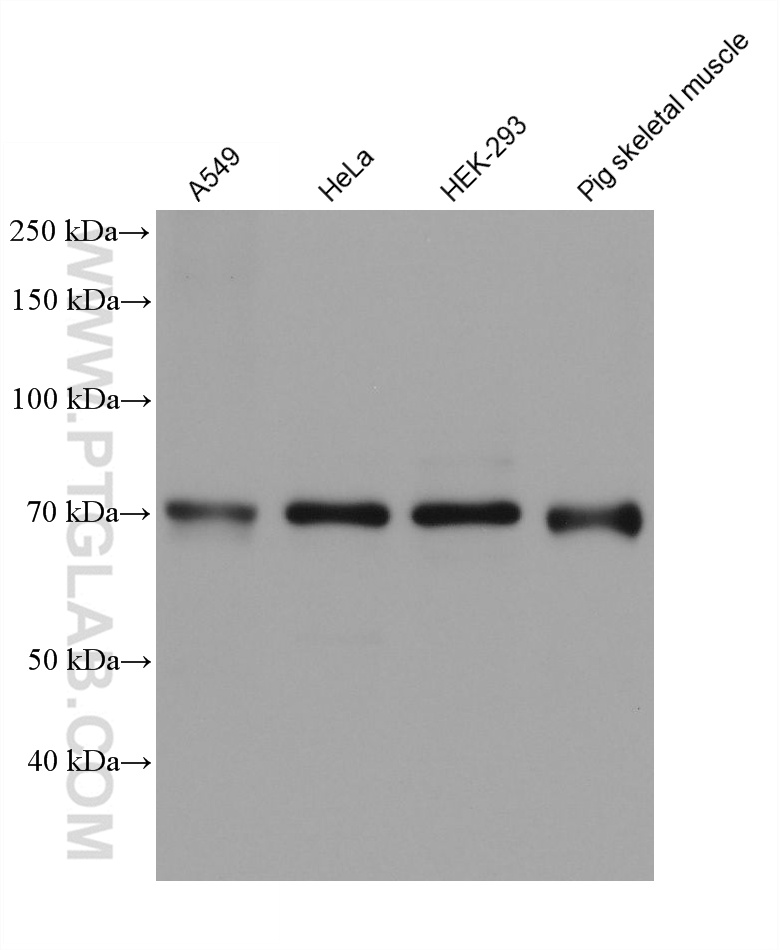 WB analysis using 60293-1-Ig (same clone as 60293-1-PBS)