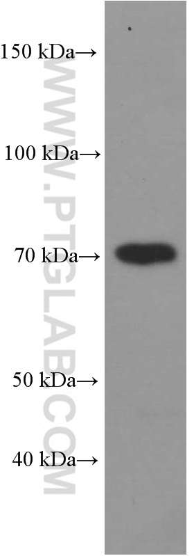 WB analysis of human brain using Biotin-60293