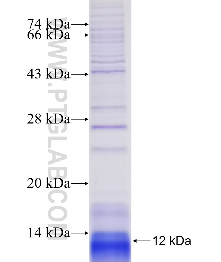 OR10H2 fusion protein Ag14988 SDS-PAGE OR10H2 fusion protein Ag14988 SDS-PAGE