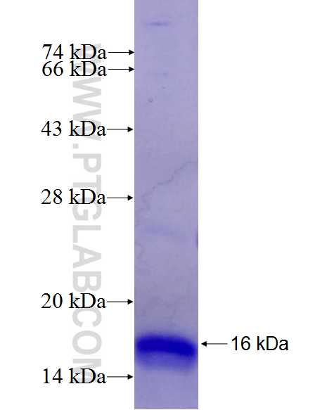 OR1L1 fusion protein Ag26827 SDS-PAGE OR1L1 fusion protein Ag26827 SDS-PAGE