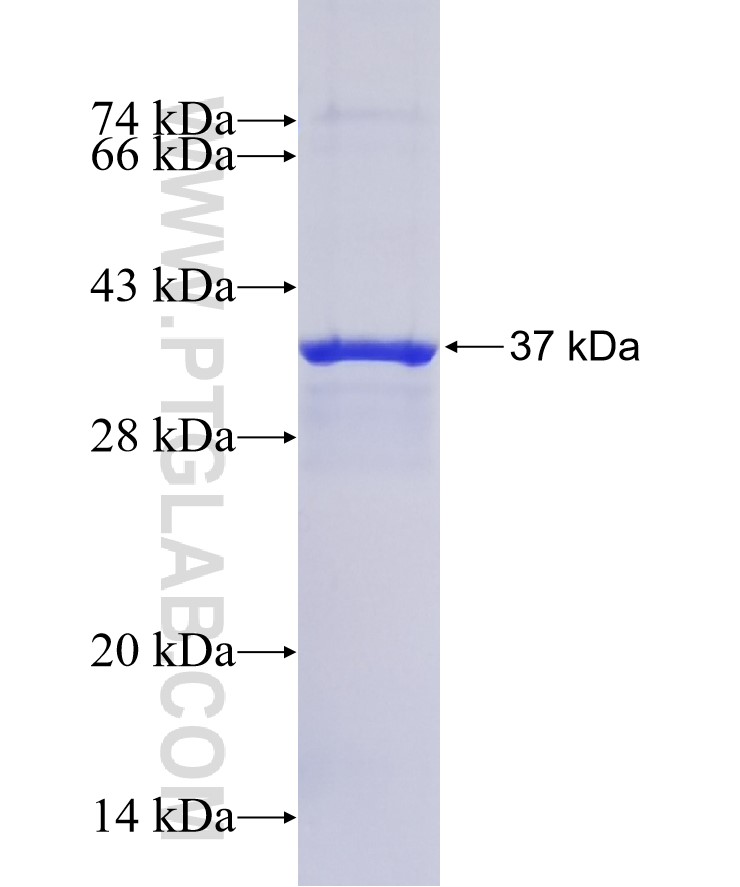 OR2S2 fusion protein Ag14928 SDS-PAGE OR2S2 fusion protein Ag14928 SDS-PAGE