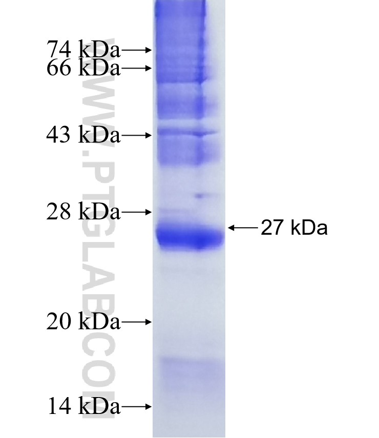 OR9Q1 fusion protein Ag13548 SDS-PAGE OR9Q1 fusion protein Ag13548 SDS-PAGE