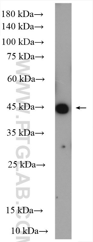 ORAI1