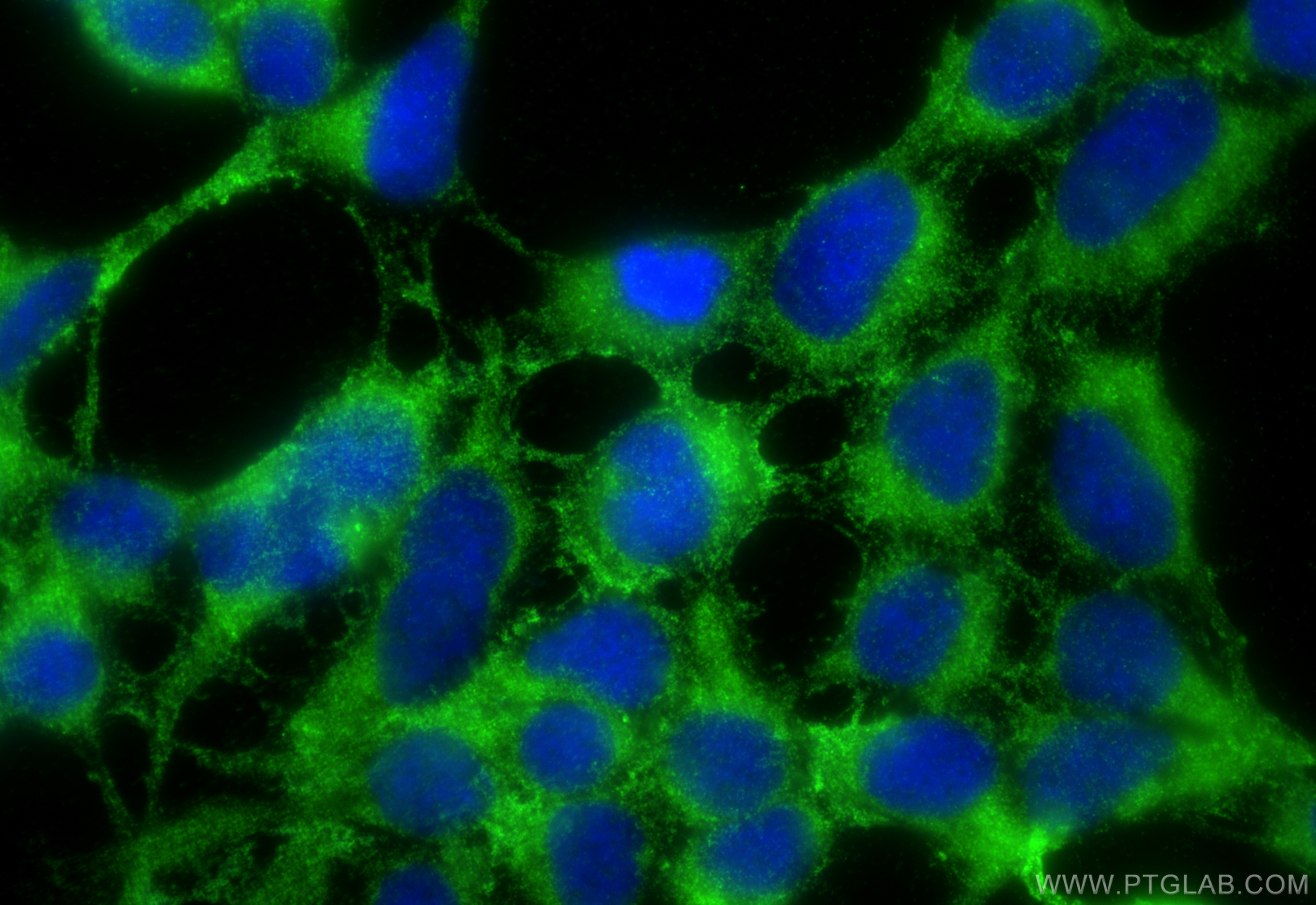 IF Staining of HEK-293 using 20592-1-AP