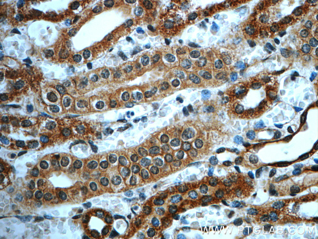 IHC staining of human kidney using 20592-1-AP