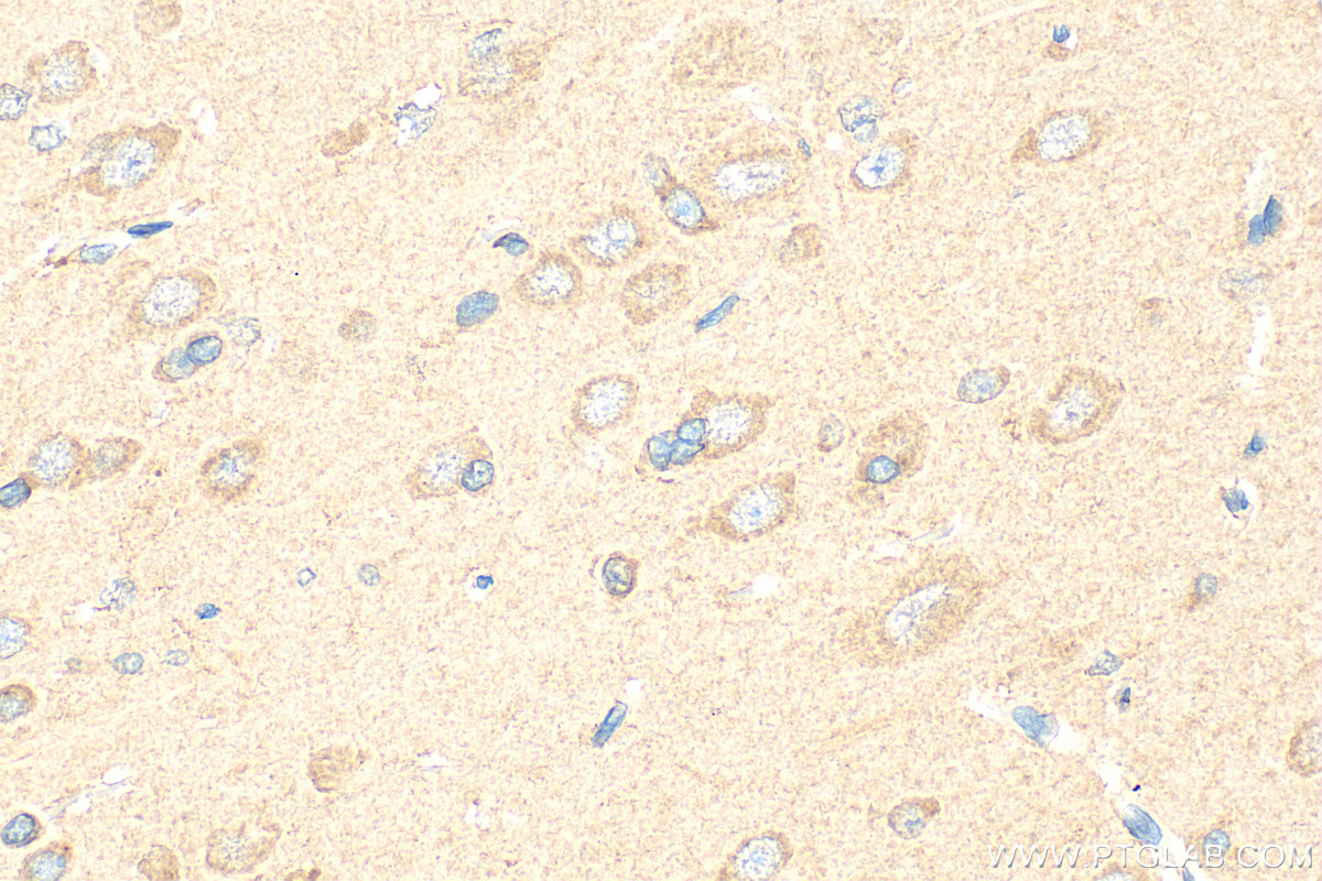 Immunohistochemical analysis of paraffin-embedded rat brain tissue slide using 20592-1-AP (ORAI2 antibody) at dilution of 1:200 (under 40x lens). Heat mediated antigen retrieval with Tris-EDTA buffer (pH 9.0). IHC staining of rat brain using 20592-1-AP
