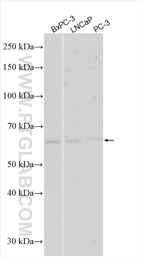 WB analysis using 25766-1-AP