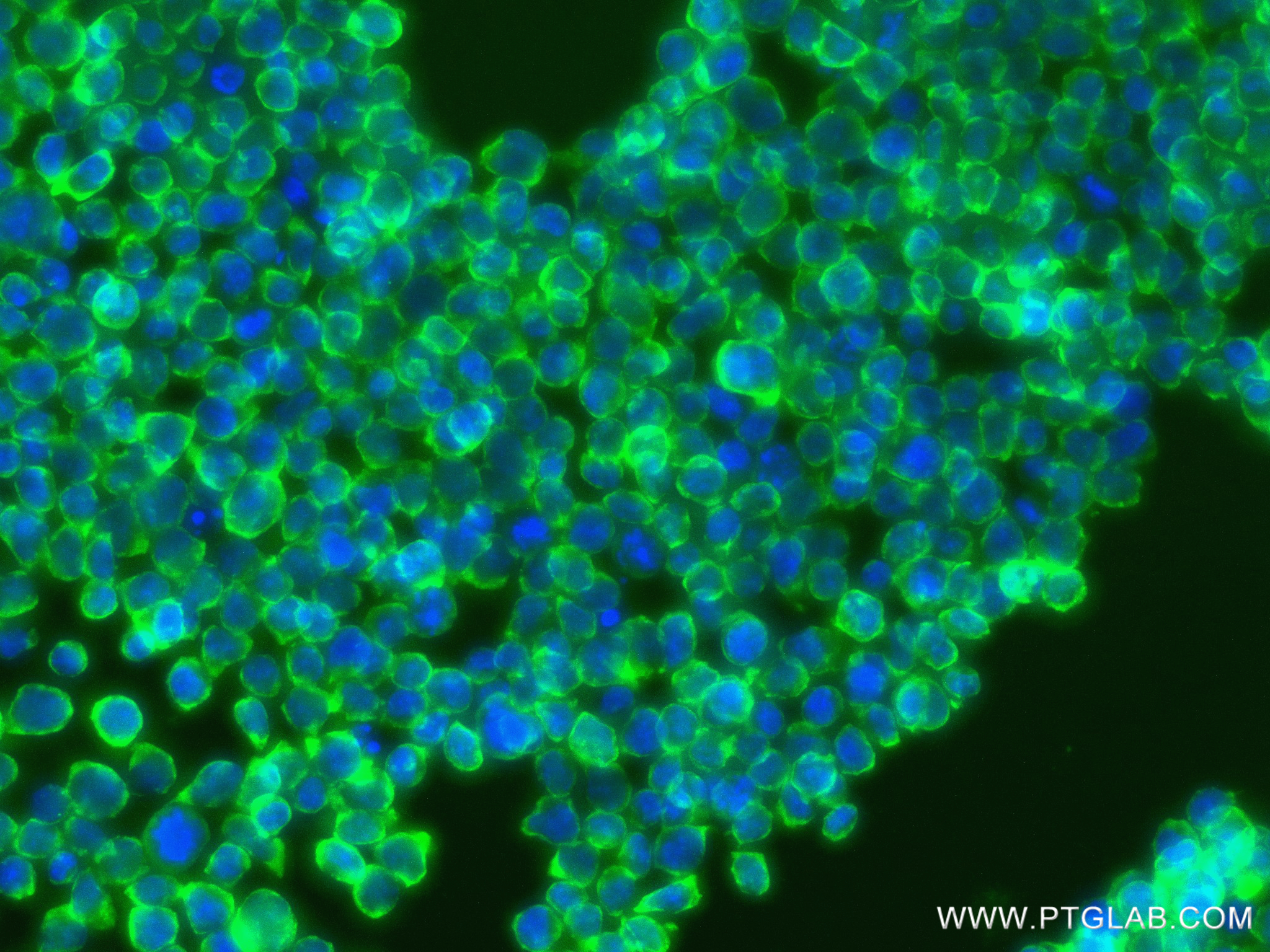 IF Staining of Jurkat using 84340-2-RR (same clone as 84340-2-PBS)