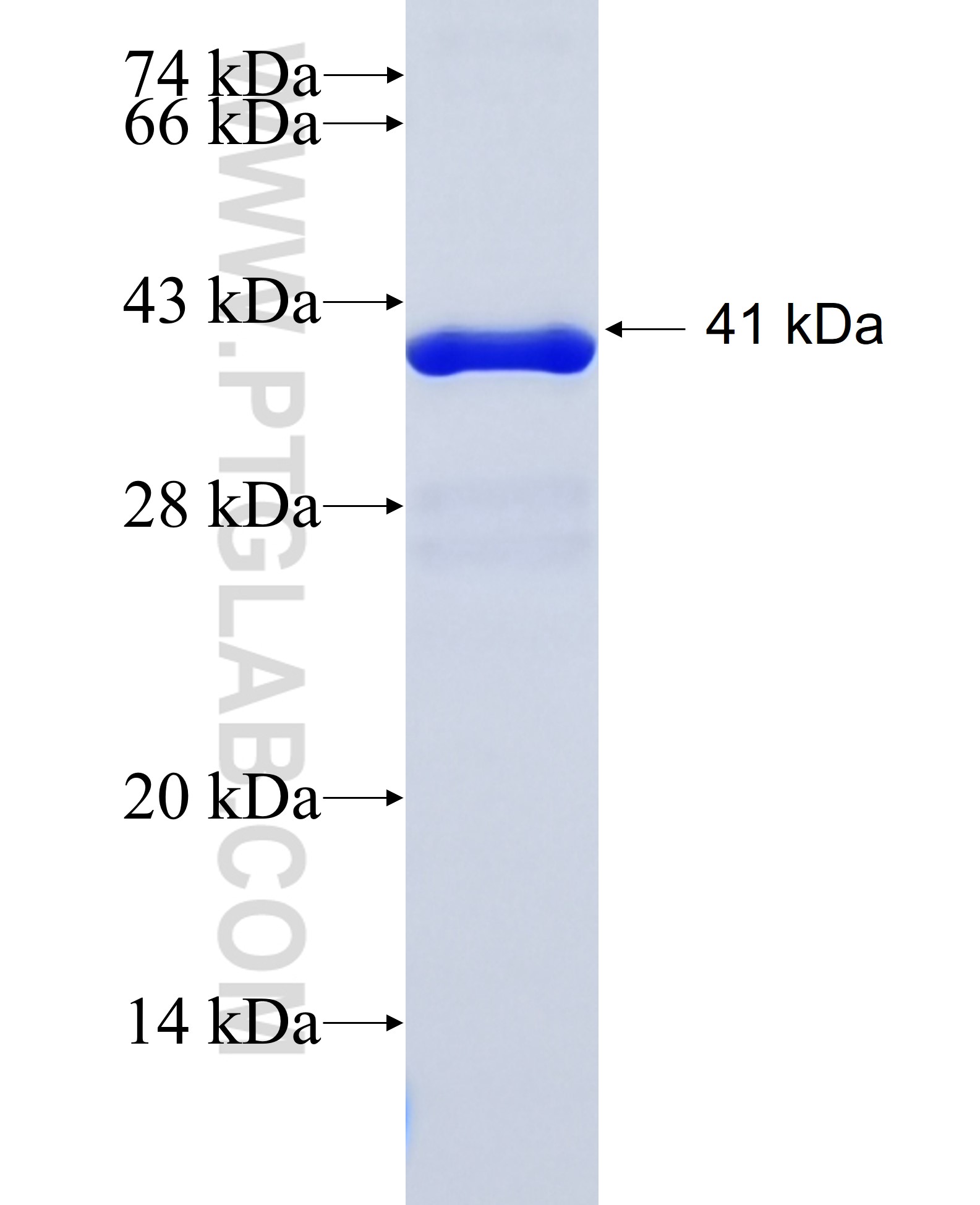 ORAOV1 fusion protein Ag38523 SDS-PAGE ORAOV1 fusion protein Ag38523 SDS-PAGE