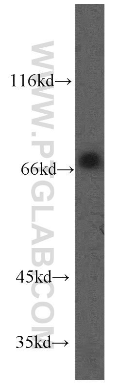 WB analysis of HepG2 using 12739-1-AP