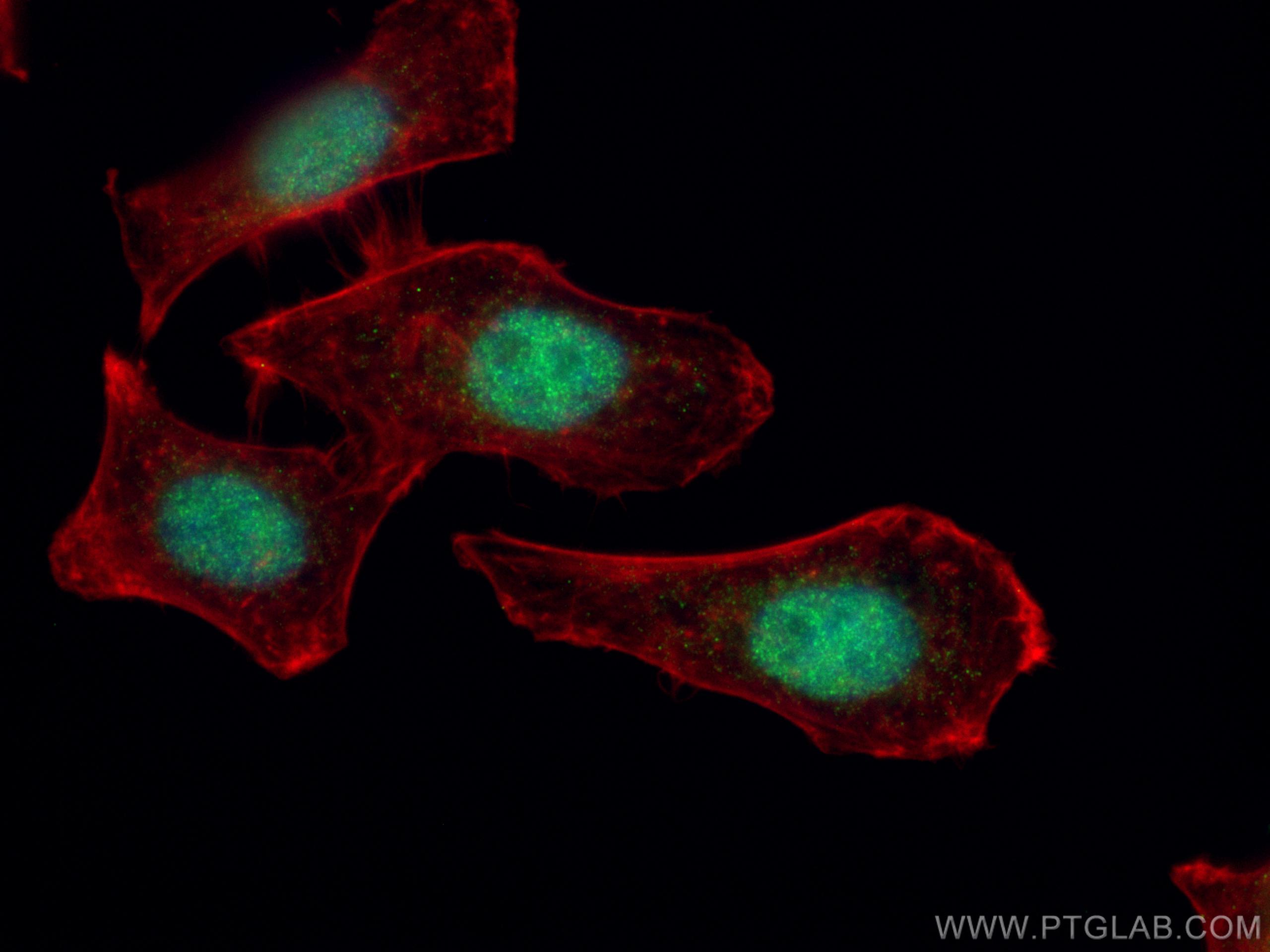 IF Staining of HepG2 using 13026-1-AP