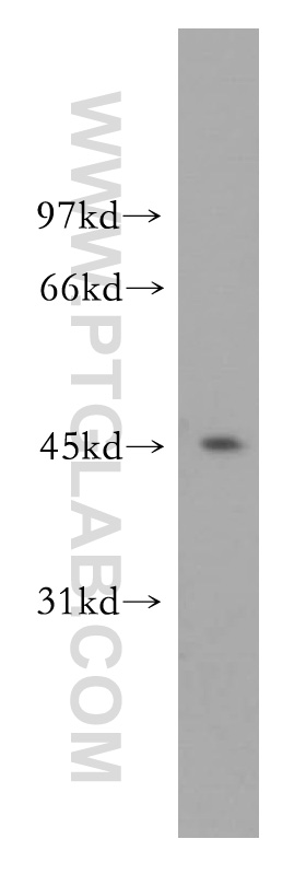 WB analysis of HeLa using 13026-1-AP