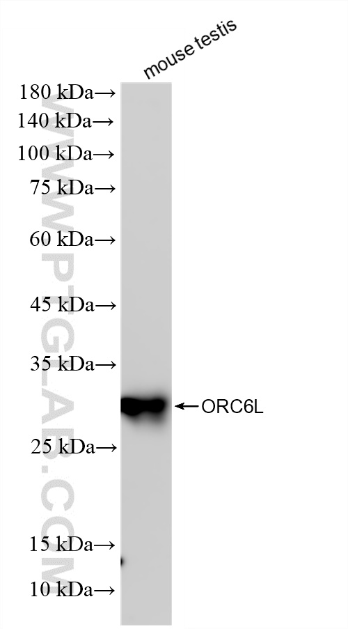 mouse testis tissue were subjected to SDS PAGE followed by western blot with 86591-1-RR (ORC6L antibody) at dilution of 1:10000 incubated at room temperature for 1.5 hours. WB analysis of mouse testis using 86591-1-RR
