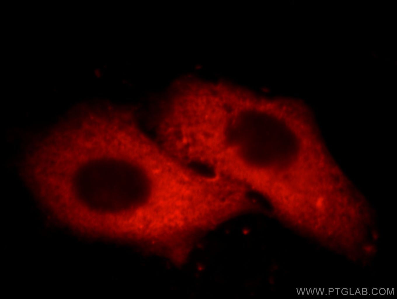 IF Staining of HepG2 using 66097-1-Ig