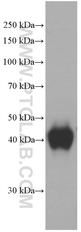 WB analysis of human plasma using 66097-1-Ig