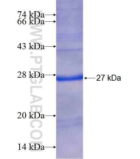 ORM2 fusion protein Ag18984 SDS-PAGE