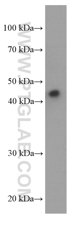 WB analysis of human plasma using 66217-1-Ig (same clone as 66217-1-PBS)