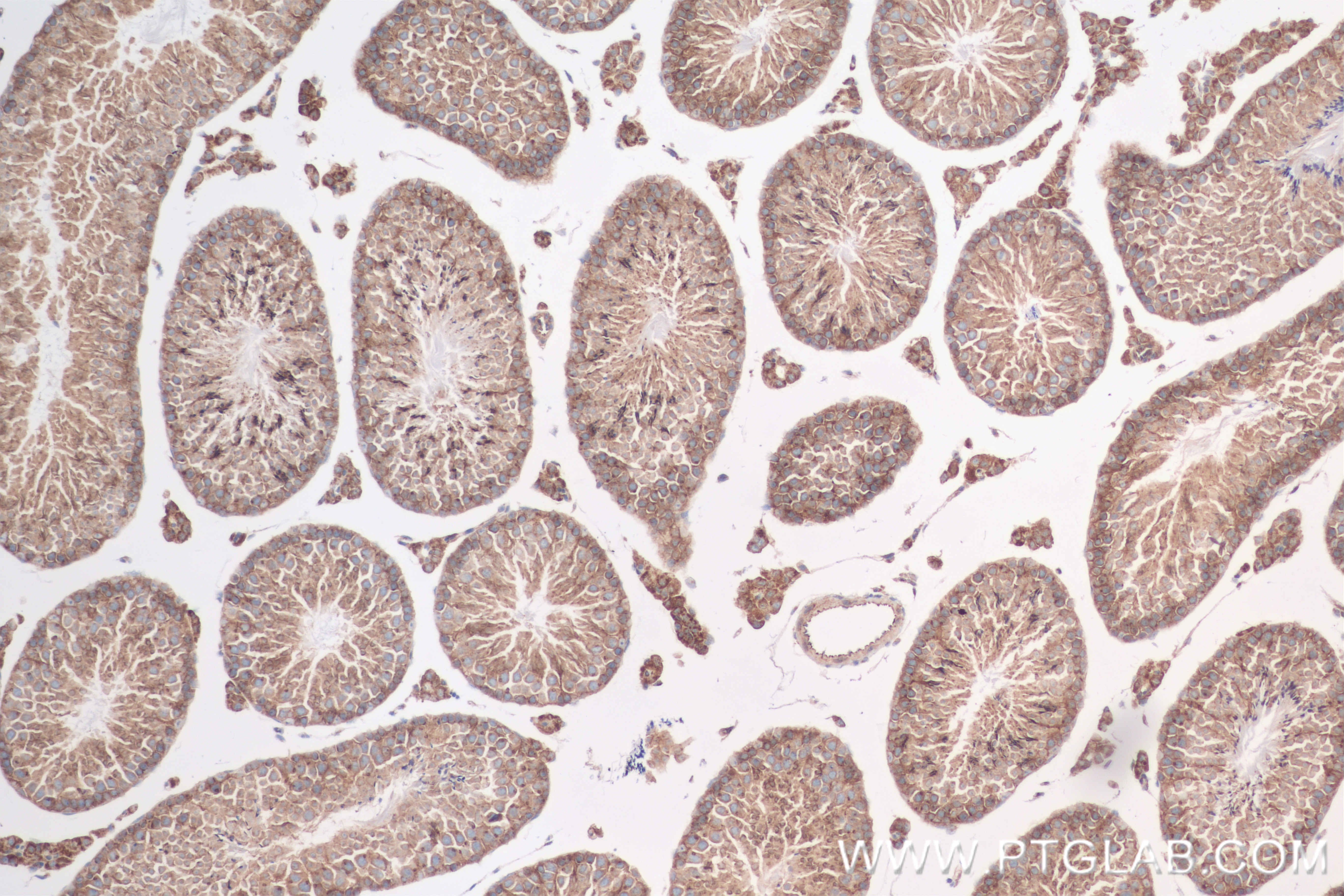 IHC staining of mouse testis using 82932-1-RR (same clone as 82932-1-PBS)
