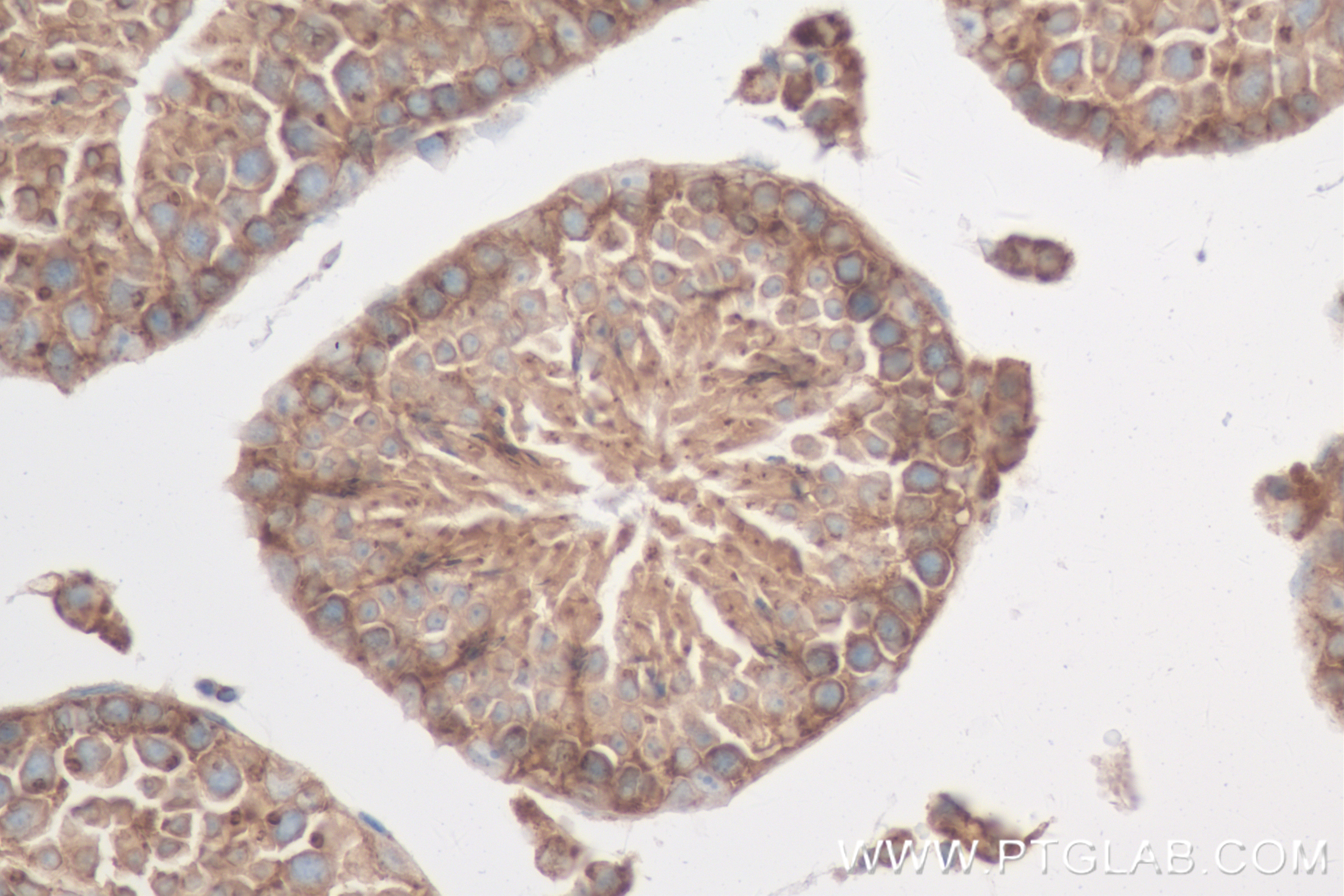 IHC staining of mouse testis using 82932-1-RR (same clone as 82932-1-PBS)