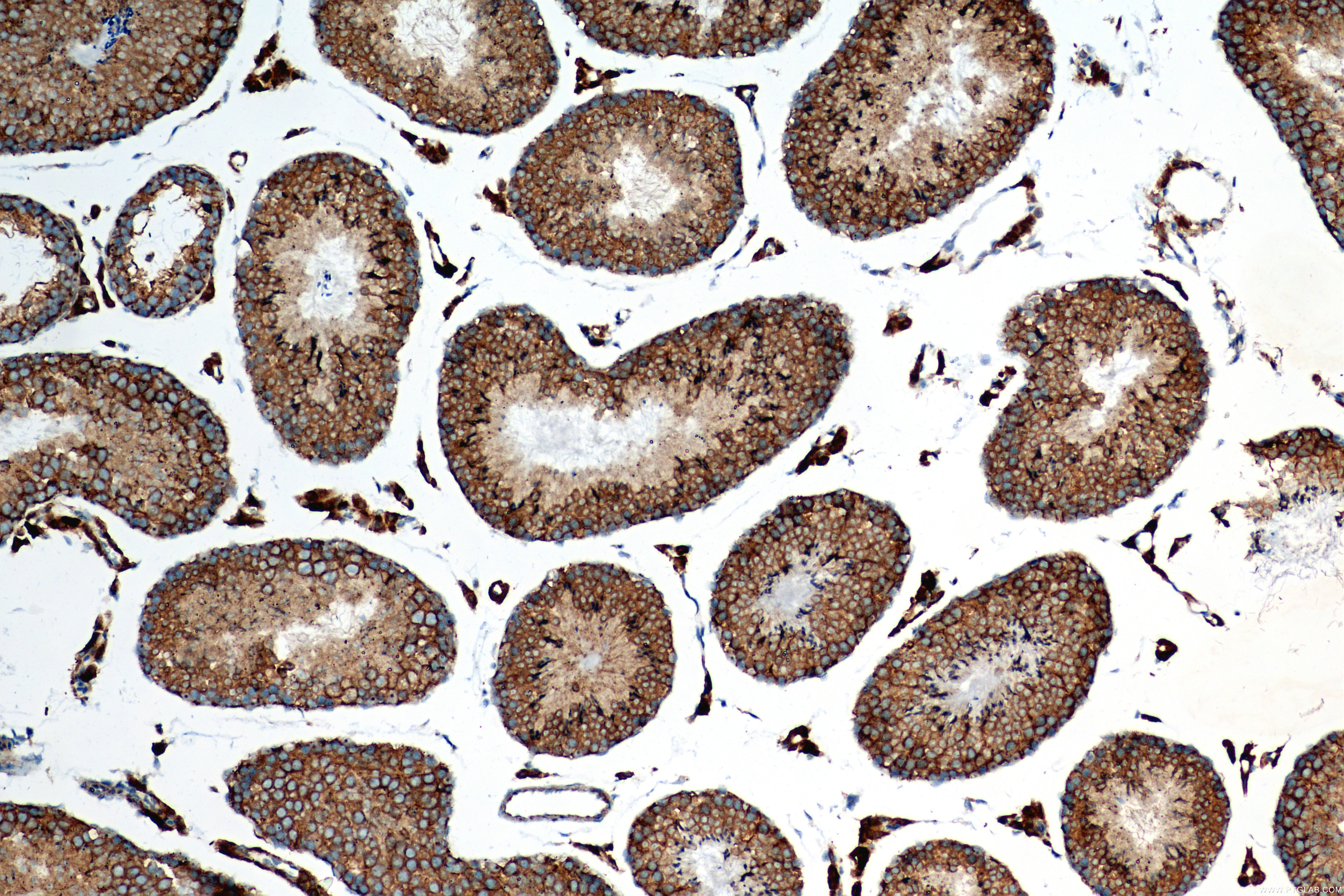 IHC staining of mouse testis using 82932-2-RR (same clone as 82932-2-PBS)