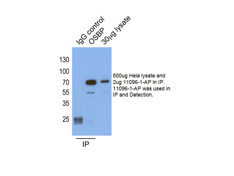 IP experiment of HeLa cells using 11096-1-AP