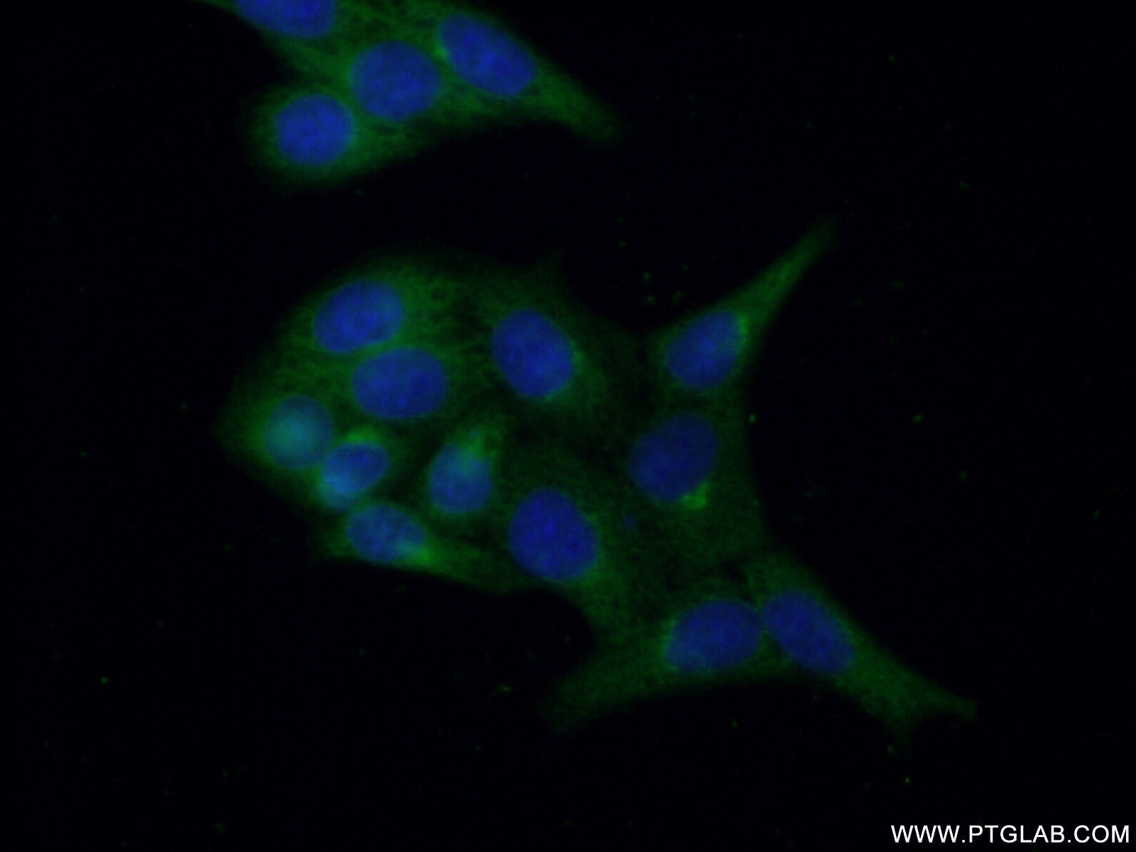 IF Staining of HeLa using 11096-1-AP
