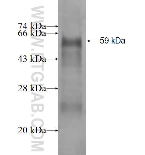 OSBP fusion protein Ag1578 SDS-PAGE